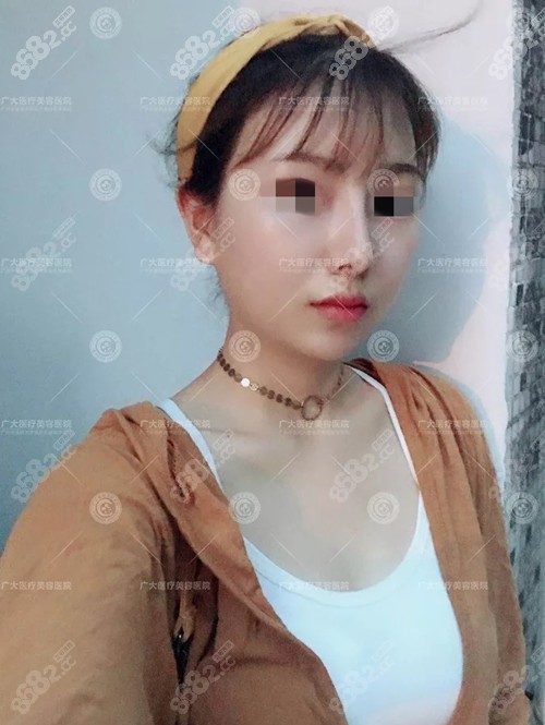 术后1个月.jpg 术后1个月.jpg