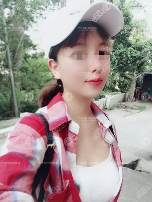 术后2个月.jpg 术后2个月.jpg