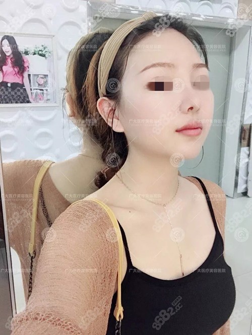 术后7天.jpg 术后7天.jpg