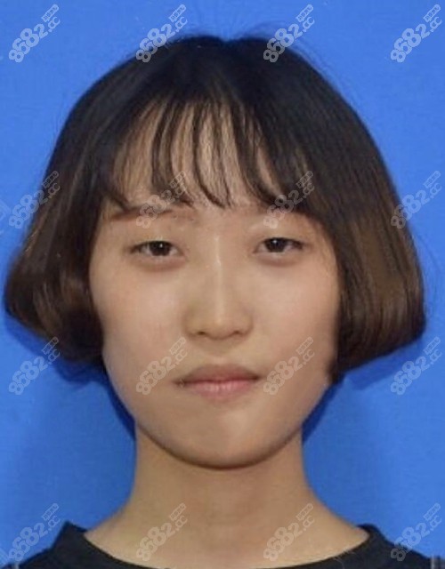 在三亚红妆尚医学美容找薛开兴做芭比眼部多项术前 在三亚红妆尚医学美容找薛开兴做芭比眼部多项术前
