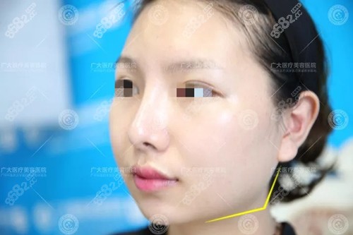 术前照片.jpg 术前照片.jpg