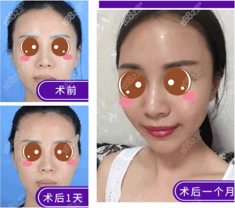 王东生长因子失败修复案例参考