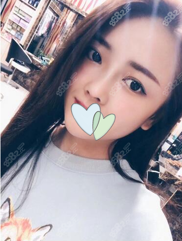 我非要找江苏省中医黄金龙做鼻子是因为效果好价格也合理