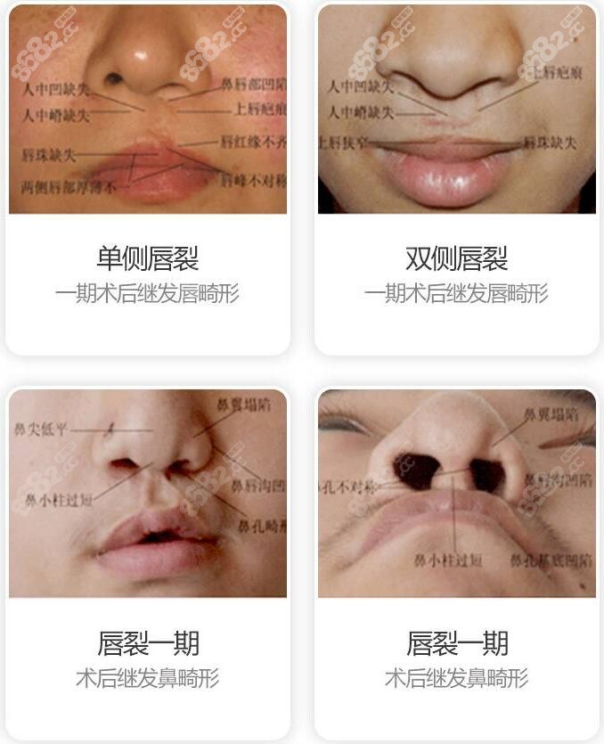 颌面外科王涛现就诊上海时光,正颌和唇腭裂修复的价格都有