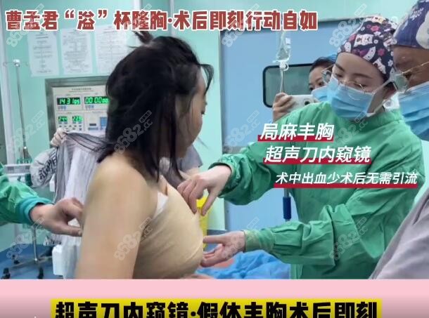 深圳曹孟君隆胸技术真好,我做傲诺拉250cc假体隆胸术后感受