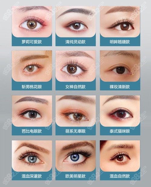 上海丽质整形全切双眼皮对比案例