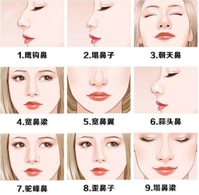 好看的鼻子万里挑一,如果你也想做一个在自己脸上有归属感的鼻子,不妨