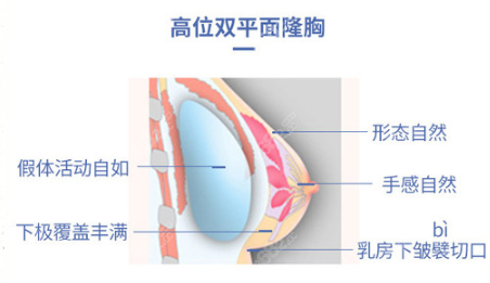 北京八大处双平面隆胸手术原理讲解