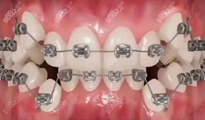 合肥美奥口腔牙齿矫正1