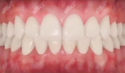 合肥美奥口腔牙齿矫正2