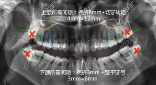 上海维乐口腔牙齿矫正术前拍片