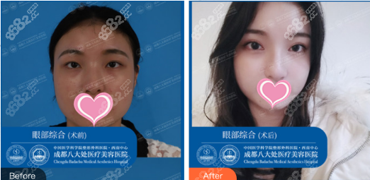 包含八大處整型醫院號販子專家預約代掛的詞條