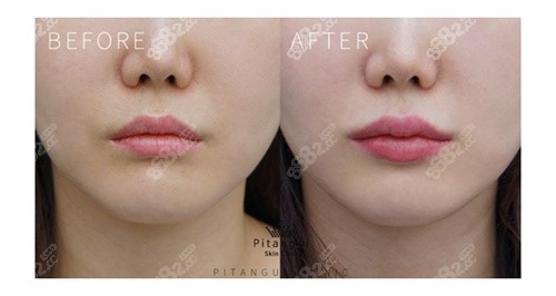 一般多久可以开始接吻 20210922162251.jpg